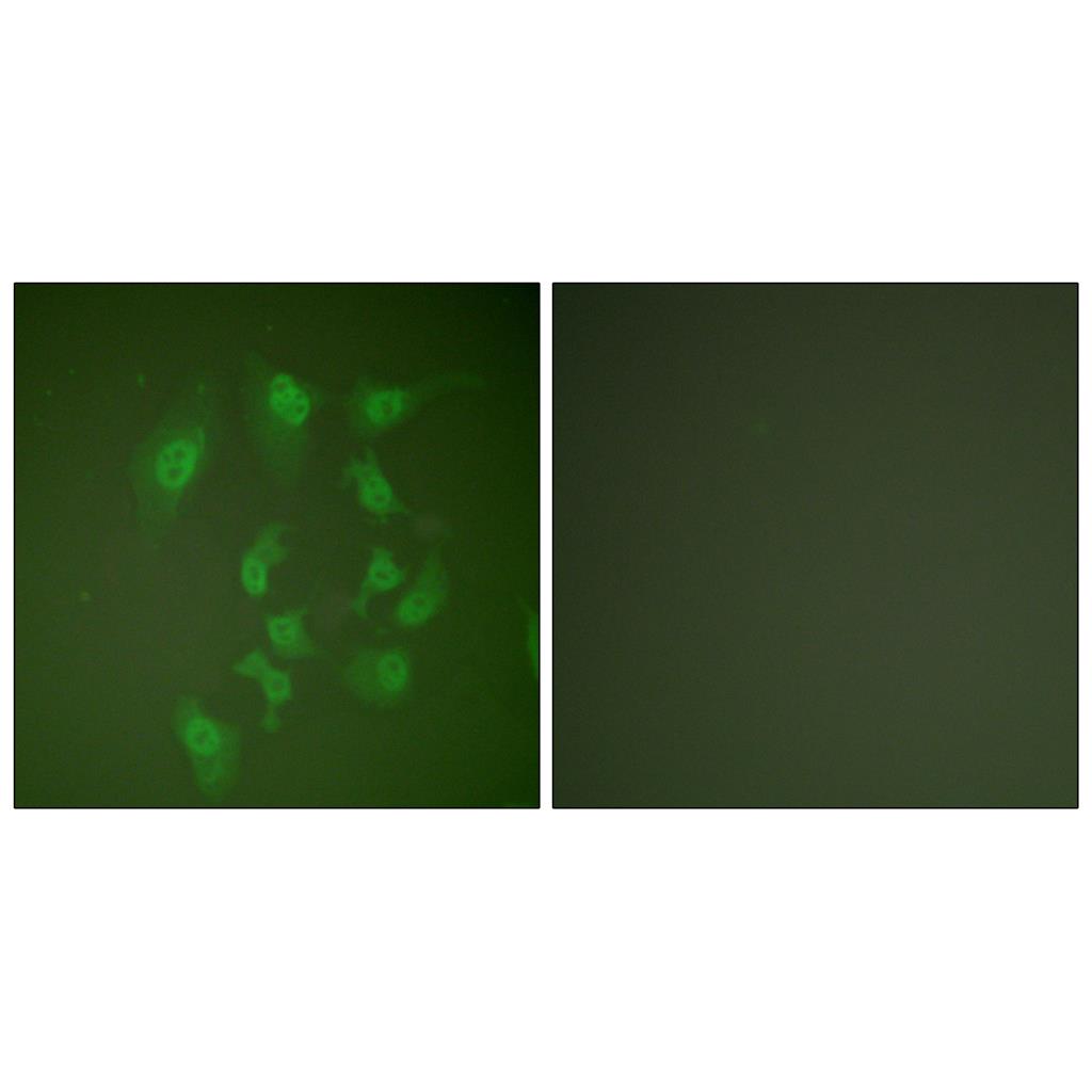 Smad2 Rabbit Polyclonal Antibody | 兔多抗 | EnkiLife恩玑生命