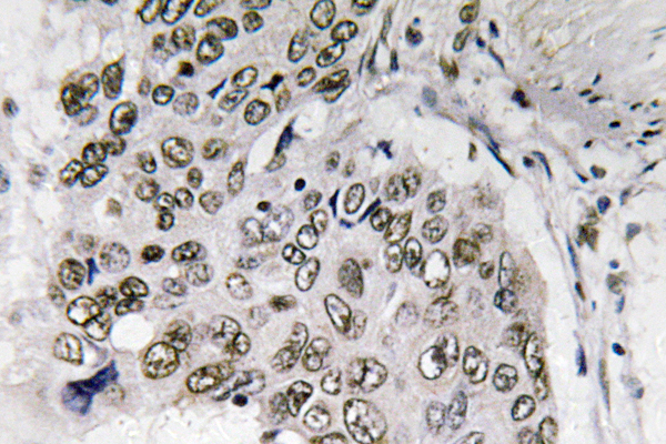 Smad6 Rabbit Polyclonal Antibody | 兔多抗 | EnkiLife恩玑生命