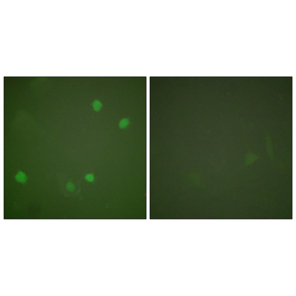 SMAP45 Rabbit Polyclonal Antibody | 兔多抗 | EnkiLife恩玑生命