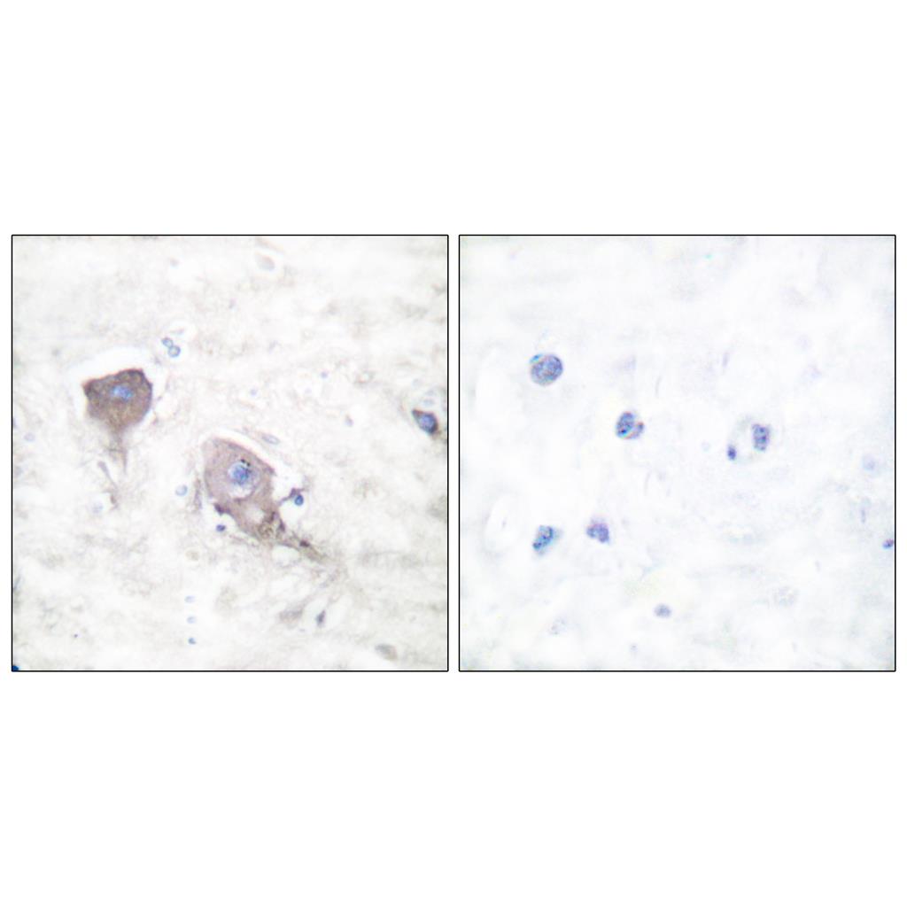 SNAP 25 Rabbit Polyclonal Antibody | 兔多抗 | EnkiLife恩玑生命