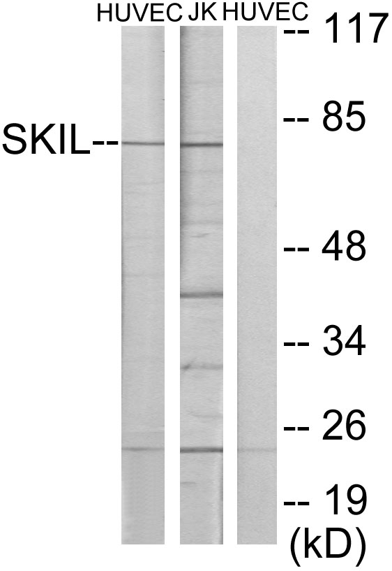 SnoN Rabbit Polyclonal Antibody | 兔多抗 | EnkiLife恩玑生命