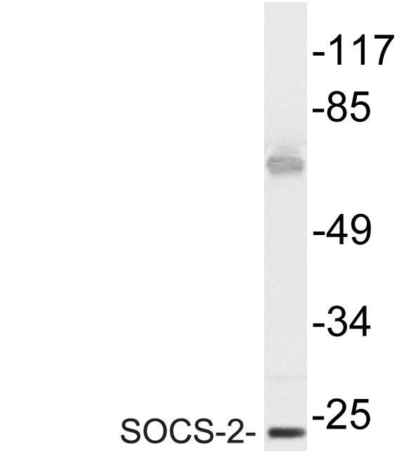 SOCS-2 Rabbit Polyclonal Antibody | 兔多抗 | EnkiLife恩玑生命