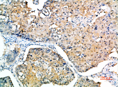 SOCS-3 Rabbit Polyclonal Antibody | 兔多抗 | EnkiLife恩玑生命