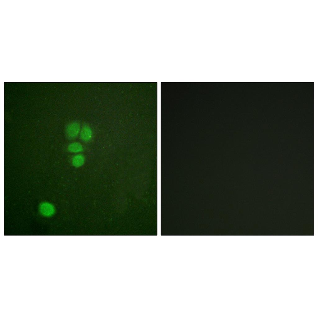 Sox-9 Rabbit Polyclonal Antibody | 兔多抗 | EnkiLife恩玑生命