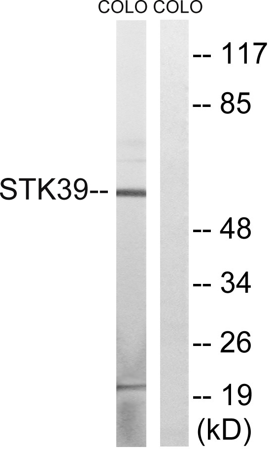 SPAK Rabbit Polyclonal Antibody | 兔多抗 | EnkiLife恩玑生命