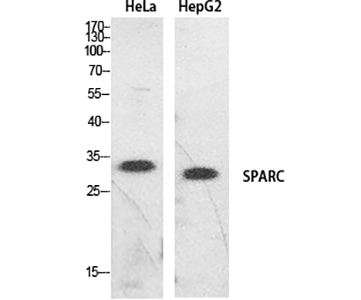 SPARC Rabbit Polyclonal Antibody | 兔多抗 | EnkiLife恩玑生命