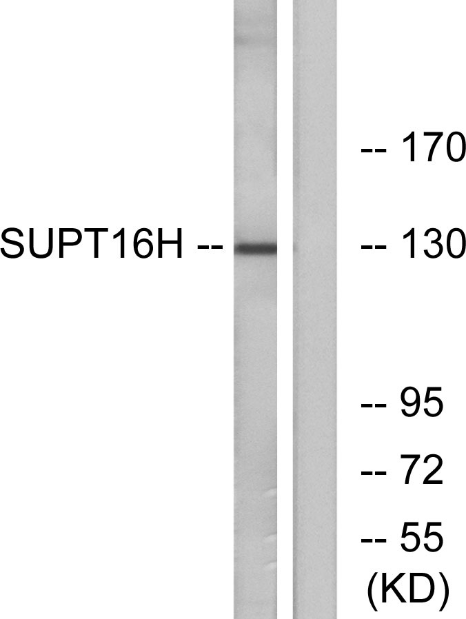 SPT16 Rabbit Polyclonal Antibody | 兔多抗 | EnkiLife恩玑生命