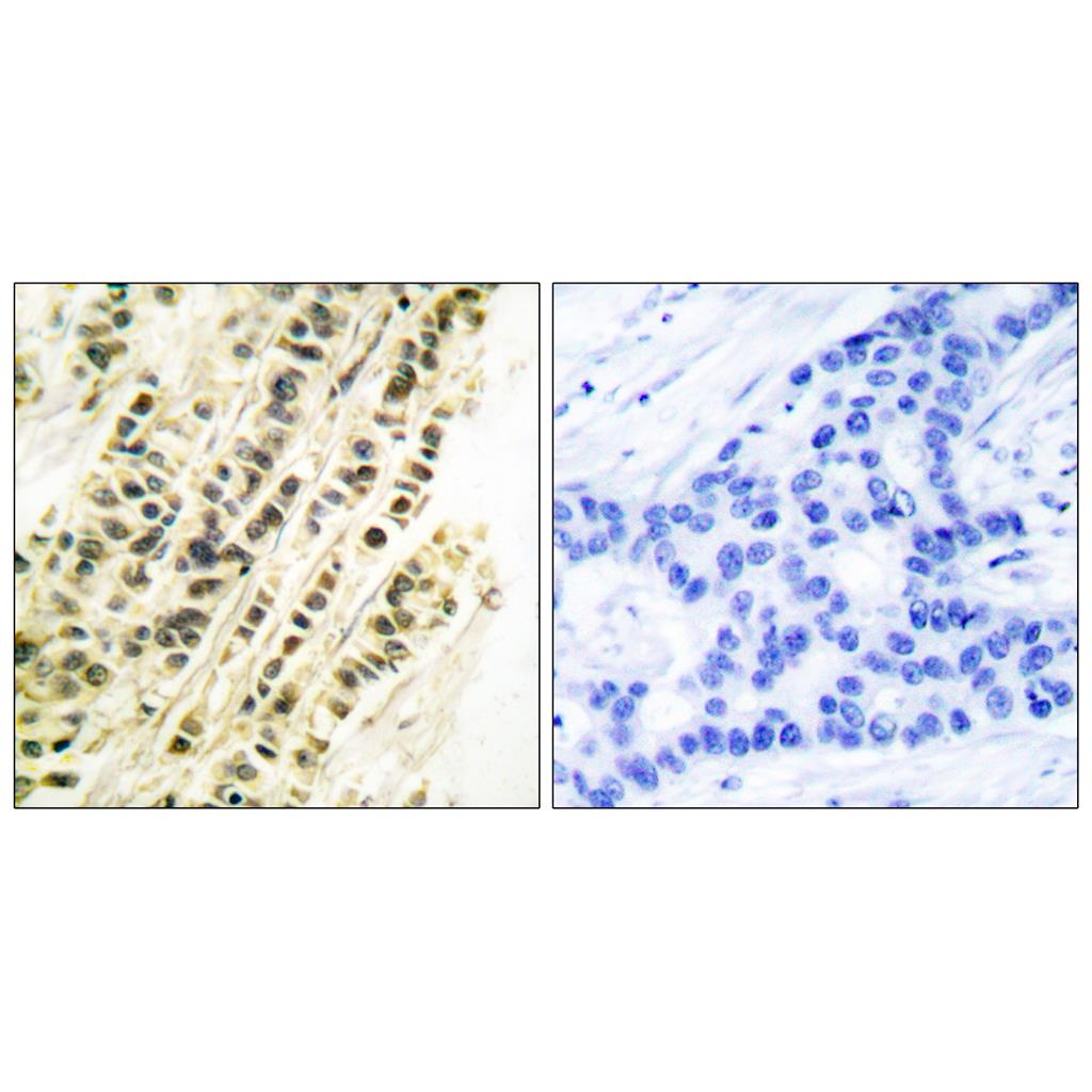 SRF Rabbit Polyclonal Antibody | 兔多抗 | EnkiLife恩玑生命