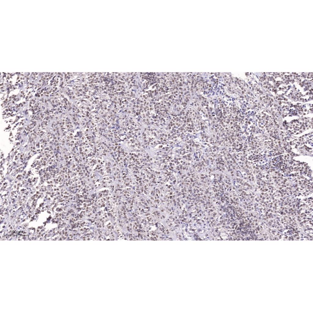 SRRM2 Rabbit Polyclonal Antibody | 兔多抗 | EnkiLife恩玑生命