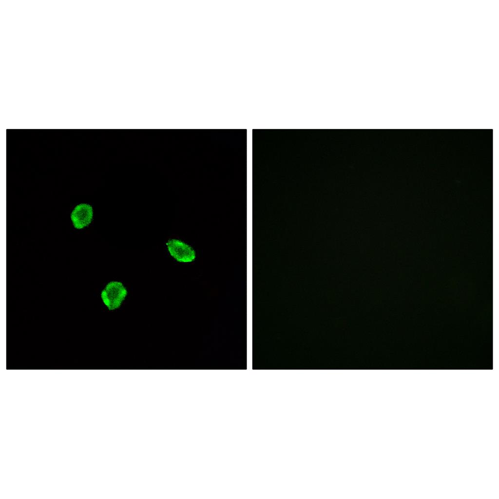 SSTR1 Rabbit Polyclonal Antibody | 兔多抗 | EnkiLife恩玑生命
