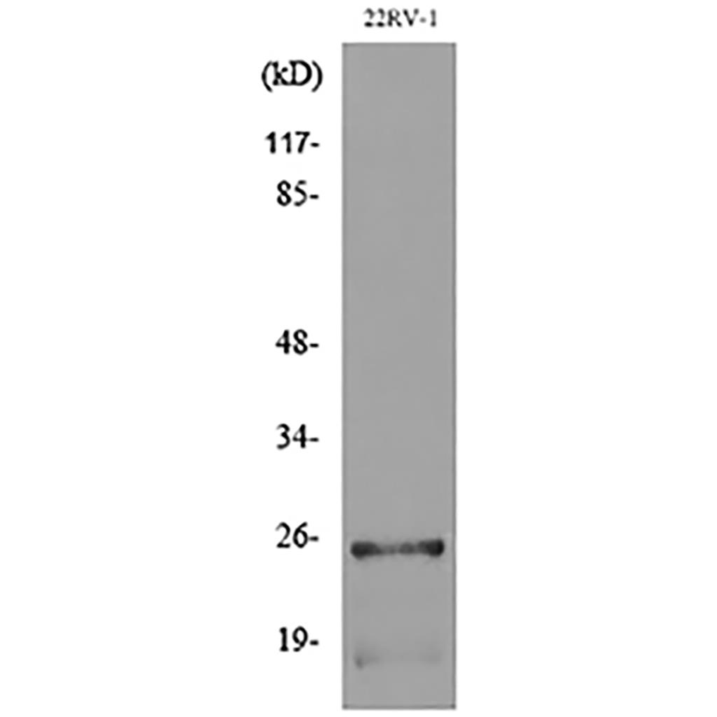 SSX Rabbit Polyclonal Antibody | 兔多抗 | EnkiLife恩玑生命