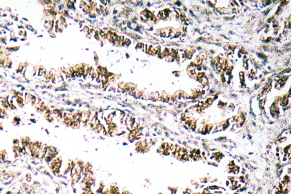 STEAP1 Rabbit Polyclonal Antibody | 兔多抗 | EnkiLife恩玑生命