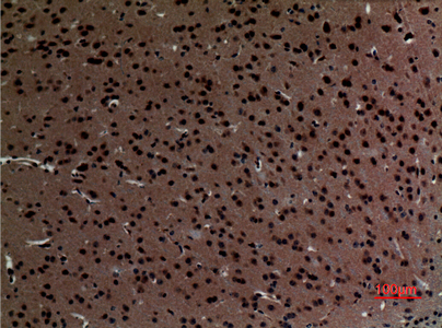 Striatin Rabbit Polyclonal Antibody | 兔多抗 | EnkiLife恩玑生命