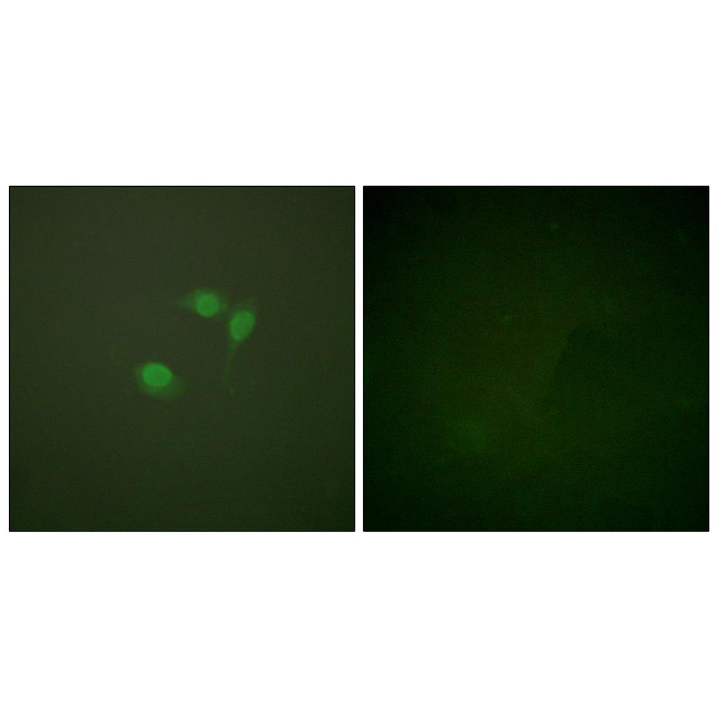 SUMO-1 Rabbit Polyclonal Antibody | 兔多抗 | EnkiLife恩玑生命