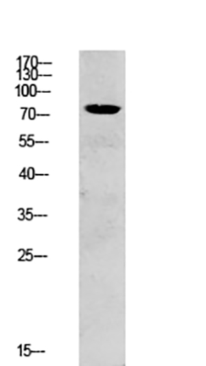 SYK Rabbit Polyclonal Antibody | 兔多抗 | EnkiLife恩玑生命
