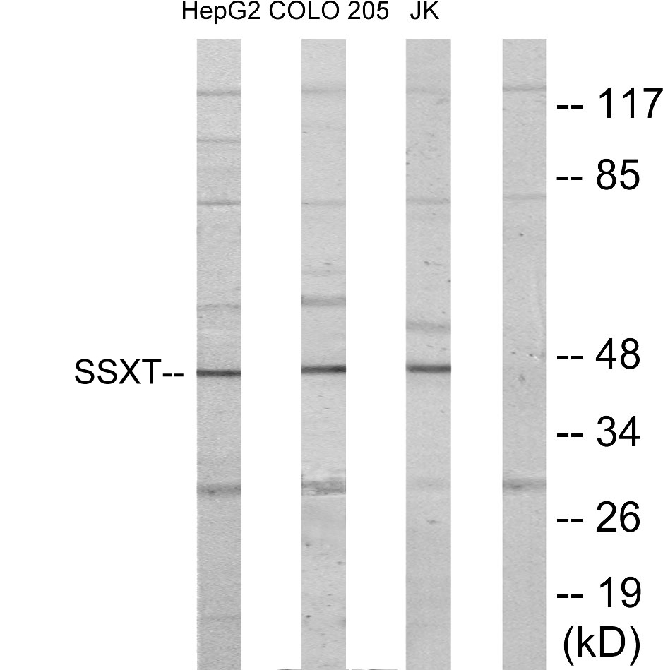 SYT Rabbit Polyclonal Antibody | 兔多抗 | EnkiLife恩玑生命