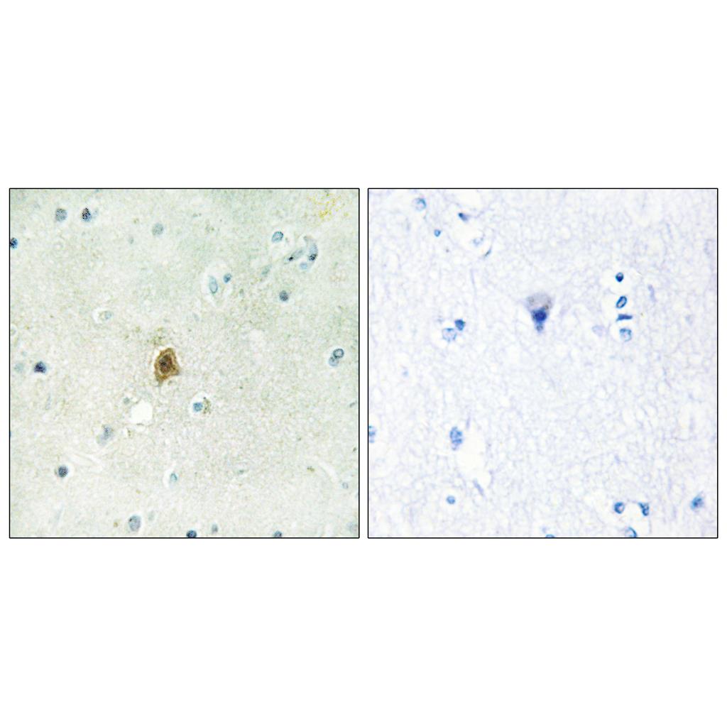 TAF II p68 Rabbit Polyclonal Antibody | 兔多抗 | EnkiLife恩玑生命