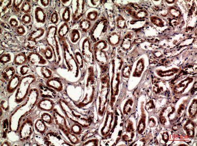 Talin-1 Rabbit Polyclonal Antibody | 兔多抗 | EnkiLife恩玑生命