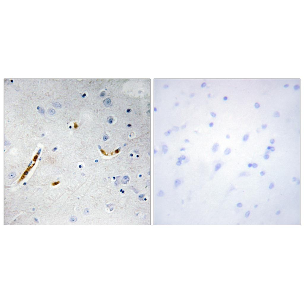 TCF-3 Rabbit Polyclonal Antibody | 兔多抗 | EnkiLife恩玑生命