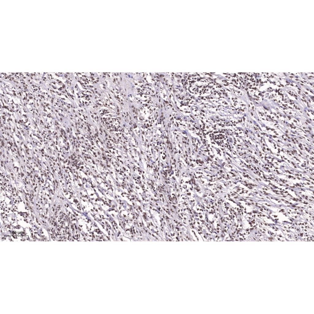 TEF-1 Rabbit Polyclonal Antibody | 兔多抗 | EnkiLife恩玑生命