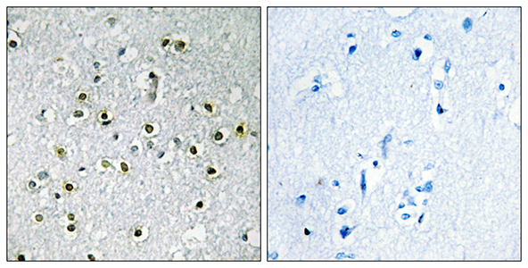 TFE3 Rabbit Polyclonal Antibody | 兔多抗 | EnkiLife恩玑生命