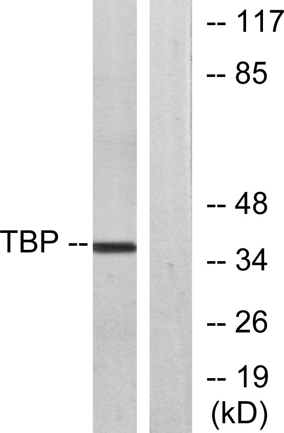 TFIID Rabbit Polyclonal Antibody | 兔多抗 | EnkiLife恩玑生命