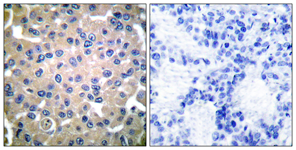 TGase2 Rabbit Polyclonal Antibody | 兔多抗 | EnkiLife恩玑生命