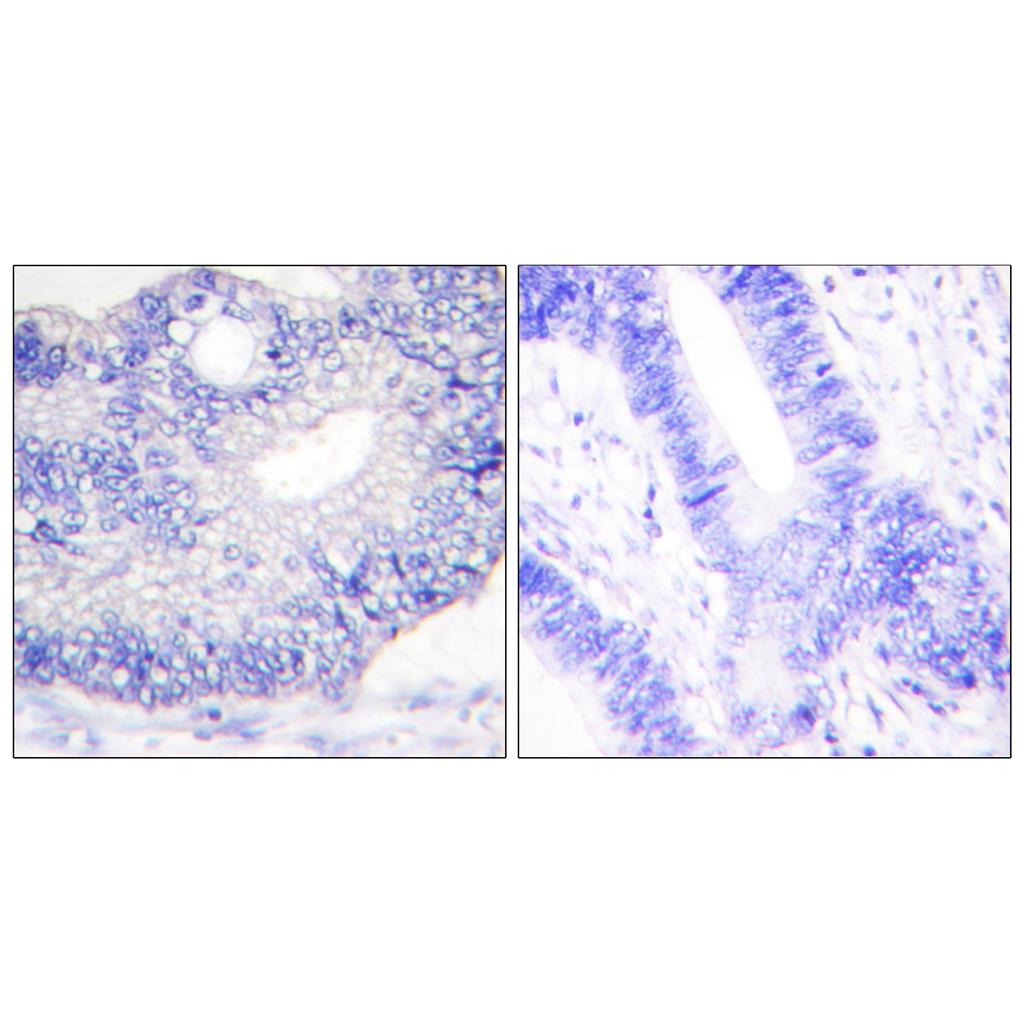 TGFα Rabbit Polyclonal Antibody | 兔多抗 | EnkiLife恩玑生命