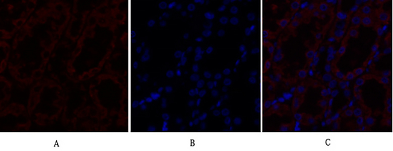 TGFβ RII Rabbit Polyclonal Antibody | 兔多抗 | EnkiLife恩玑生命