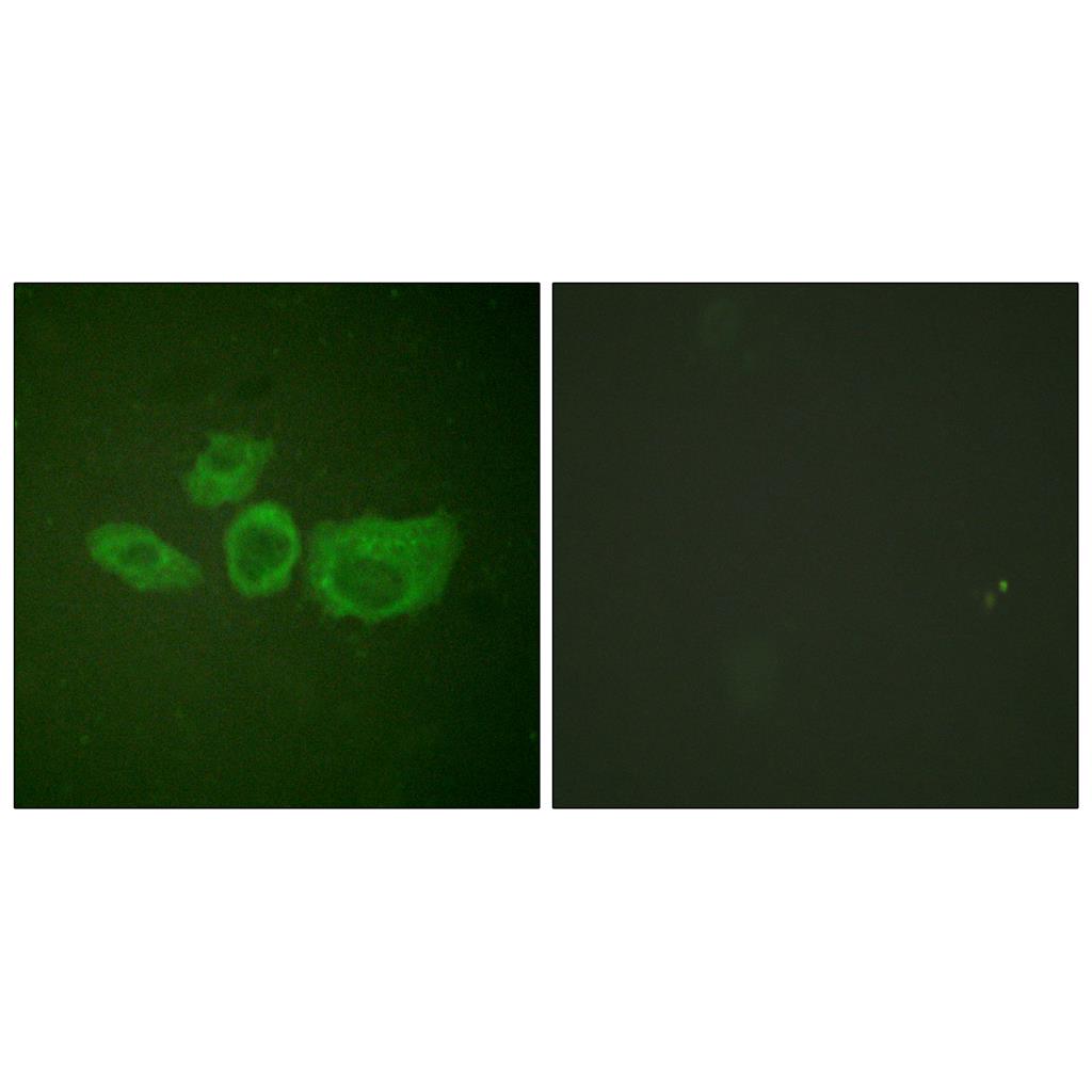 TH Rabbit Polyclonal Antibody | 兔多抗 | EnkiLife恩玑生命