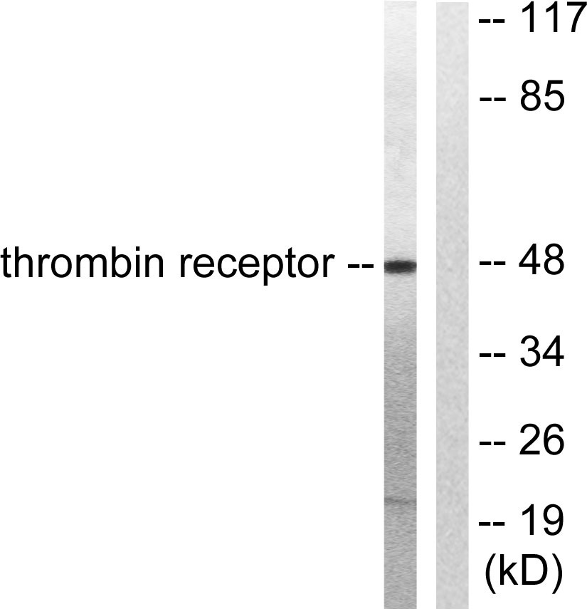 Thrombin R Rabbit Polyclonal Antibody | 兔多抗 | EnkiLife恩玑生命