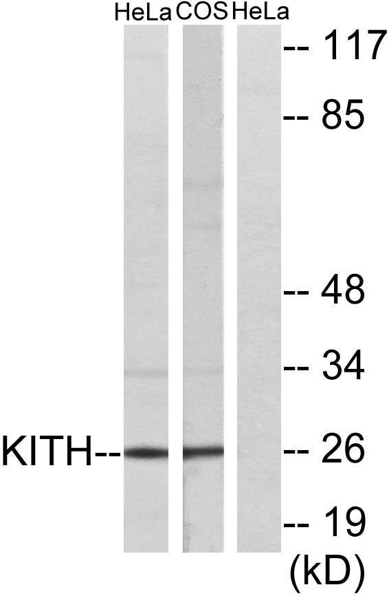 Thymidine Kinase Rabbit Polyclonal Antibody | 兔多抗 | EnkiLife恩玑生命