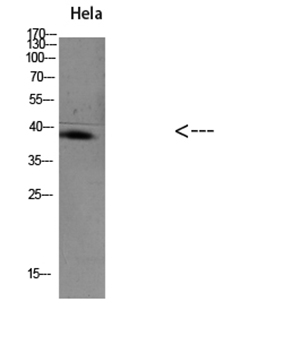 TIM-1 Rabbit Polyclonal Antibody | 兔多抗 | EnkiLife恩玑生命