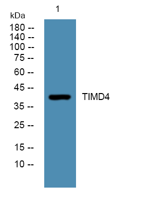 TIMD4 Rabbit Polyclonal Antibody | 兔多抗 | EnkiLife恩玑生命