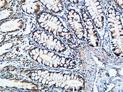 TIMP-2 Rabbit Polyclonal Antibody | 兔多抗 | EnkiLife恩玑生命