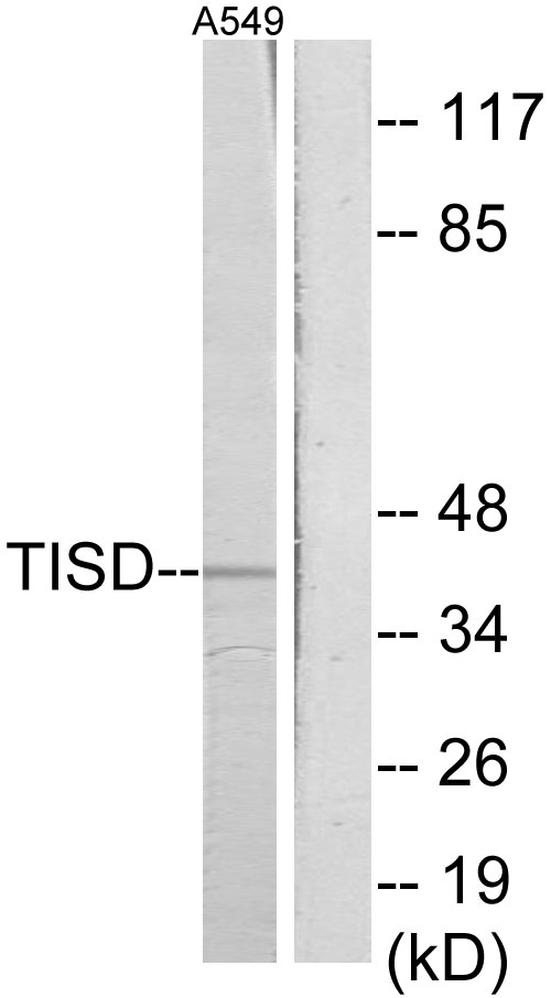 TIS11D Rabbit Polyclonal Antibody | 兔多抗 | EnkiLife恩玑生命