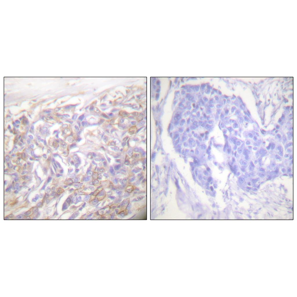 TNF-R1 Rabbit Polyclonal Antibody | 兔多抗 | EnkiLife恩玑生命
