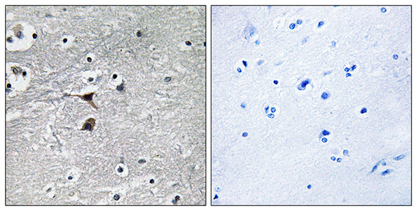 TPH1 Rabbit Polyclonal Antibody | 兔多抗 | EnkiLife恩玑生命