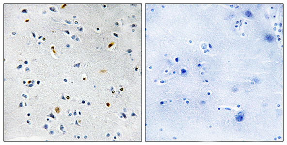 TPX2 Rabbit Polyclonal Antibody | 兔多抗 | EnkiLife恩玑生命