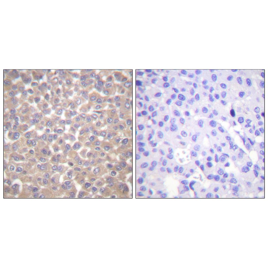 TRADD Rabbit Polyclonal Antibody | 兔多抗 | EnkiLife恩玑生命