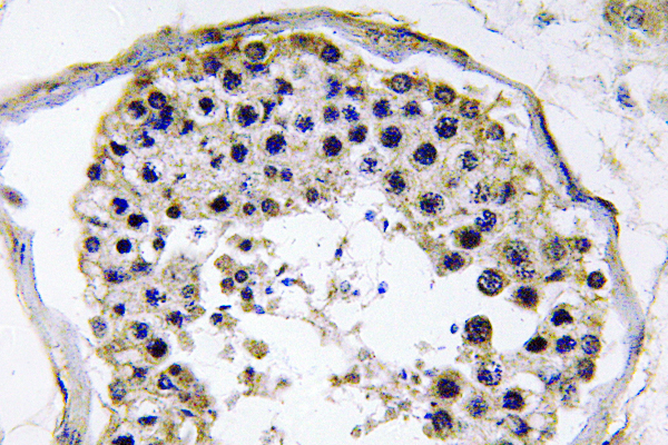 TRAF6 Rabbit Polyclonal Antibody | 兔多抗 | EnkiLife恩玑生命