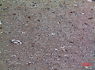 TREM-1 Rabbit Polyclonal Antibody | 兔多抗 | EnkiLife恩玑生命