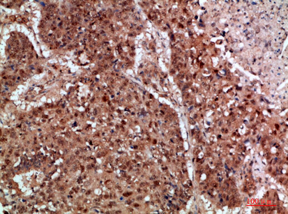 TRIF Rabbit Polyclonal Antibody | 兔多抗 | EnkiLife恩玑生命