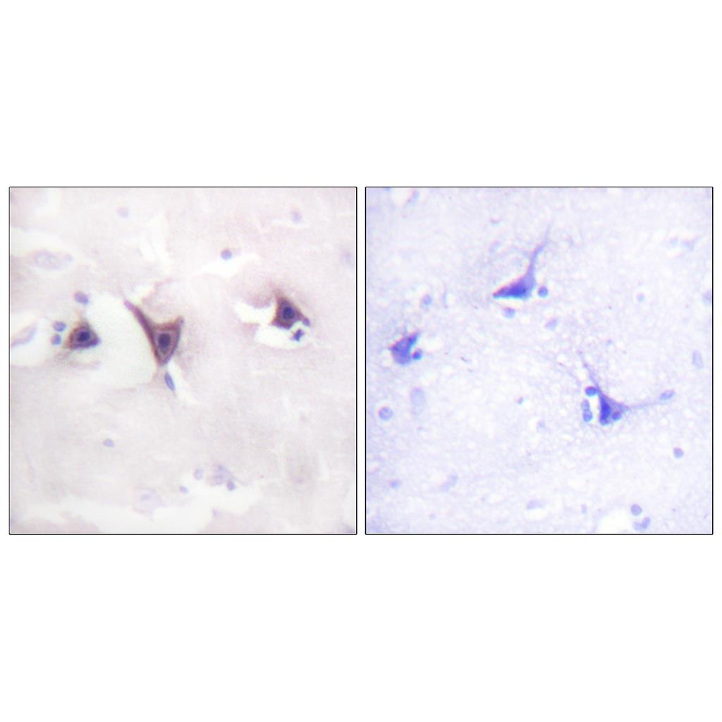 Trk B Rabbit Polyclonal Antibody | 兔多抗 | EnkiLife恩玑生命