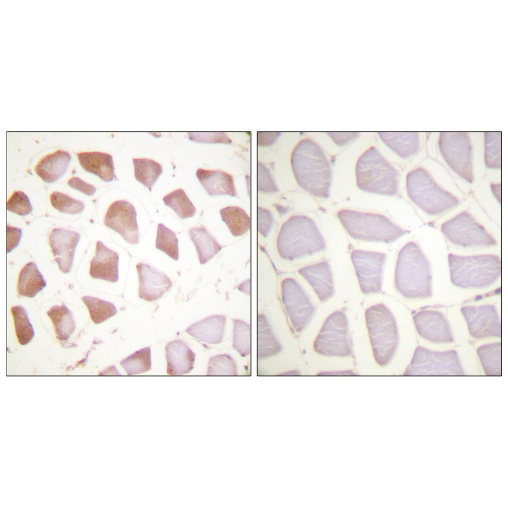 Troponin I-C Rabbit Polyclonal Antibody | 兔多抗 | EnkiLife恩玑生命