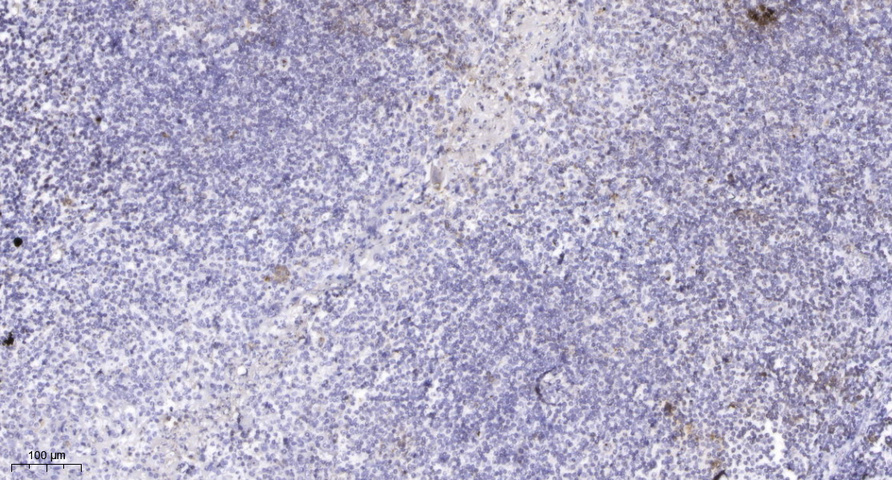 TRRAP Rabbit Polyclonal Antibody | 兔多抗 | EnkiLife恩玑生命