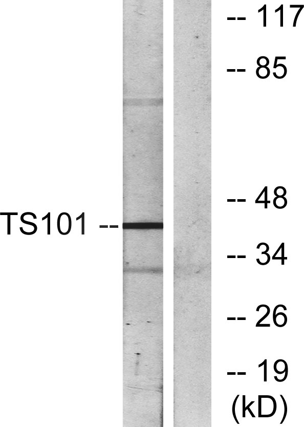 Tsg 101 Rabbit Polyclonal Antibody | 兔多抗 | EnkiLife恩玑生命