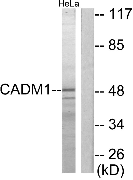 TSLC1 Rabbit Polyclonal Antibody | 兔多抗 | EnkiLife恩玑生命