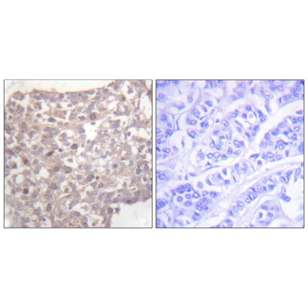 Tubulin γ Rabbit Polyclonal Antibody | 兔多抗 | EnkiLife恩玑生命