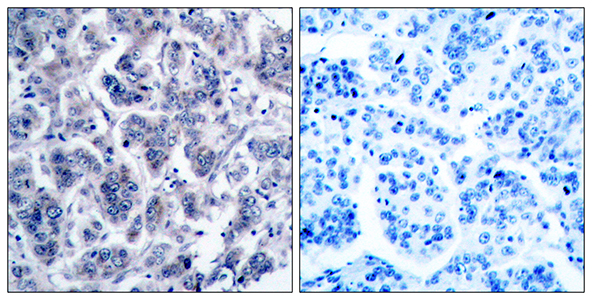 Tyk 2 Rabbit Polyclonal Antibody | 兔多抗 | EnkiLife恩玑生命